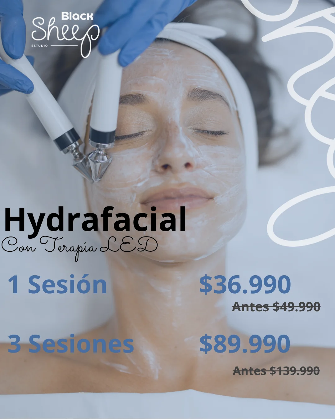 Hydrafacial