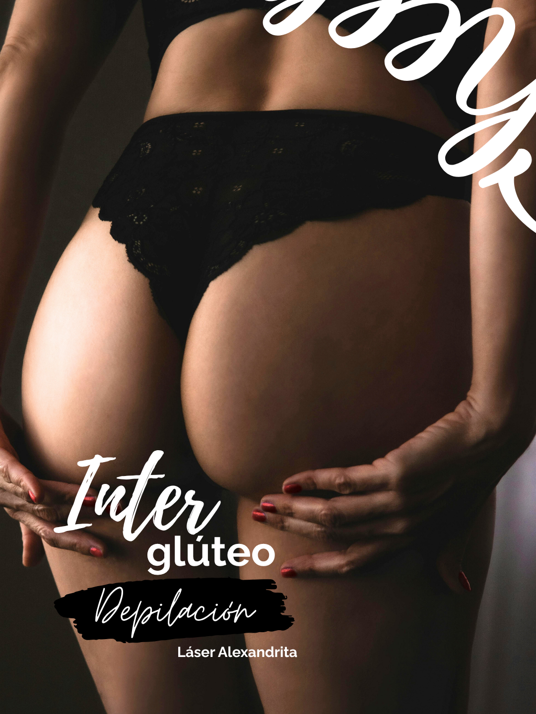 Depilación láser en línea interglútea – 6 sesiones