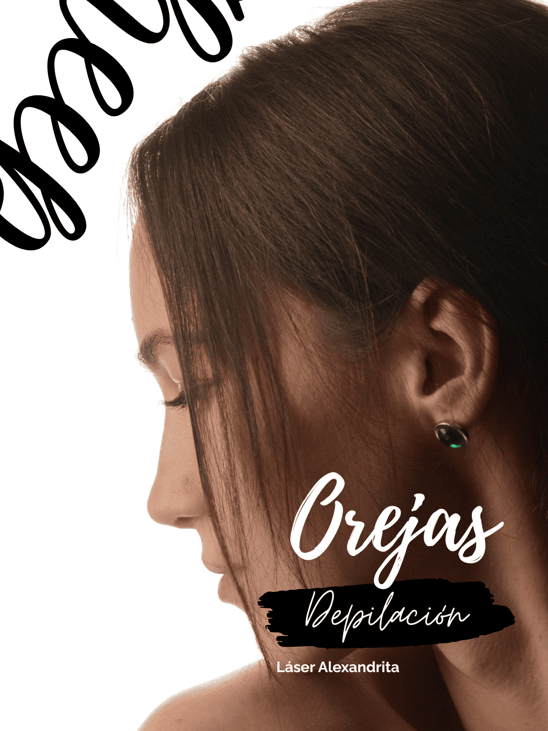 Depilación láser en orejas – 6 sesiones