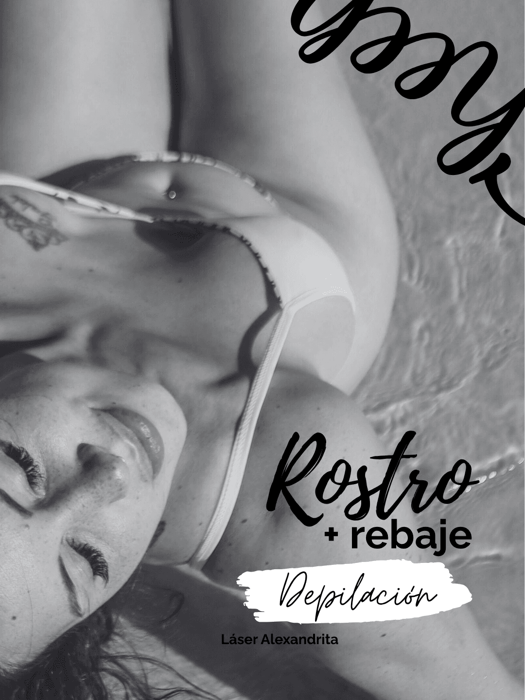 Depilación láser en rostro y rebaje – 6 sesiones