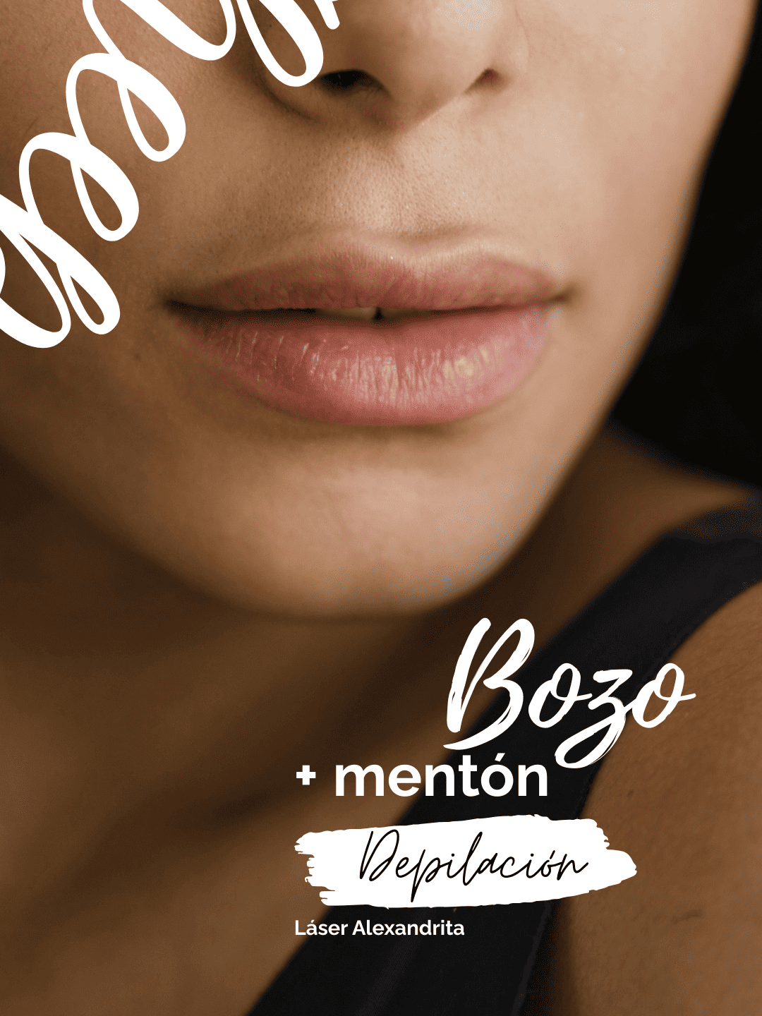 Depilación láser en bozo y mentón – 6 sesiones